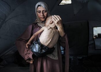 ΟΗΕ: Τα υποσιτισμένα παιδιά στη Γάζα τριπλασιάστηκαν σε 5 μήνες