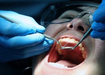 Πώς συνδέεται η ουλίτιδα με αυξημένο κίνδυνο σοβαρών καρδιαγγειακών επεισοδίων