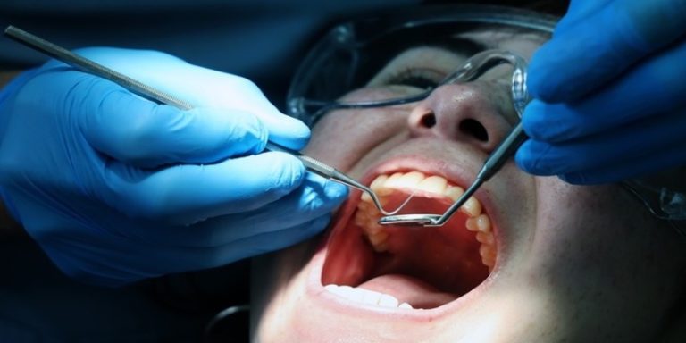 Πώς συνδέεται η ουλίτιδα με αυξημένο κίνδυνο σοβαρών καρδιαγγειακών επεισοδίων