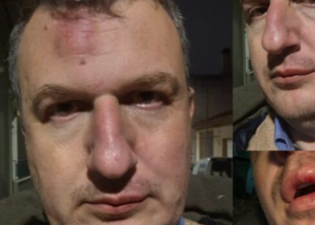 Θύμα ξυλοδαρμού έπεσε ο εκδότης Δημήτρης Καρεκλίδης στον Βόλο