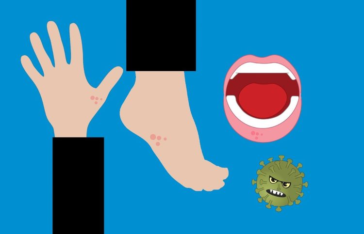 ΗΠΑ: Έκρηξη κρουσμάτων ιλαράς – Καλούν για άμεσο εμβολιασμό